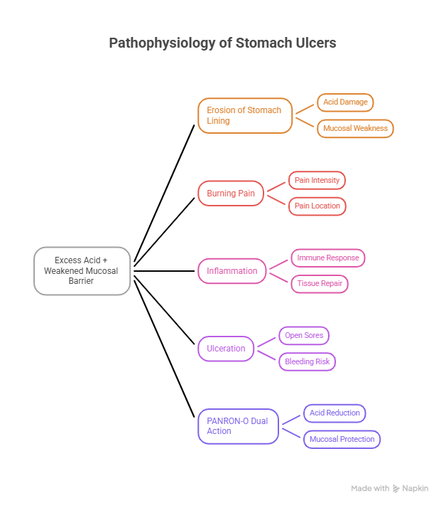 Pathophysiology of Stomach Ulcers- visual selection (2)